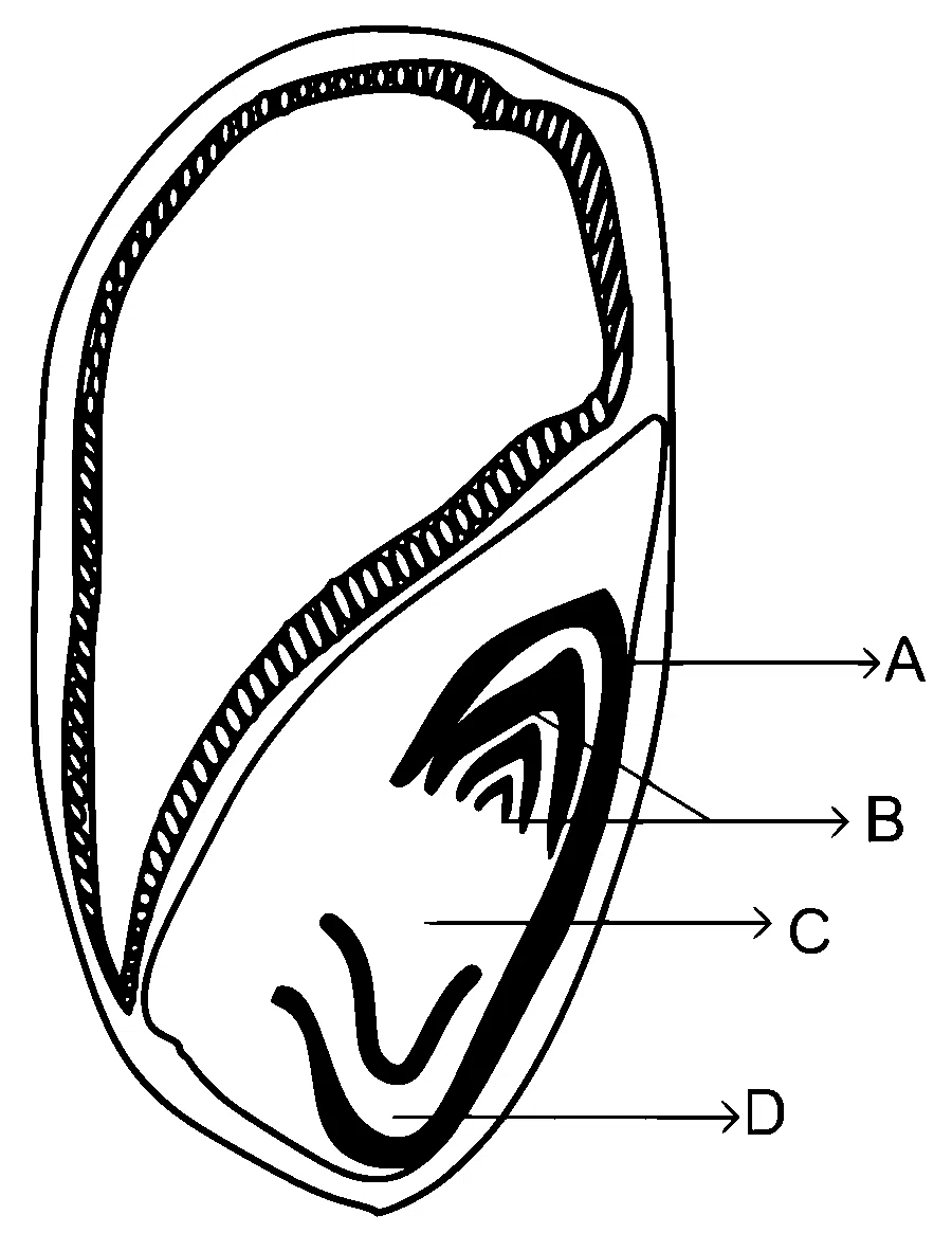 NEET 2024 Biology - Morphology of Flowering Plants Question 14 English